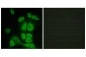 Immunofluorescence analysis of A549 cells, using FXR2 antibody. (FXR2 antibody)