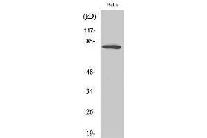 Western Blotting (WB) image for anti-Forkhead Box O1 (FOXO1) (Ser38) antibody (ABIN3184664) (FOXO1 antibody  (Ser38))