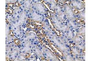 ABIN6260962 and ABIN6268678 at 1/100 staining Mouse brain tissue by IHC-P. (GJB1 antibody  (Internal Region))
