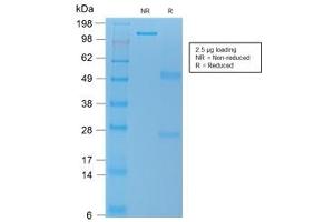 SDS-PAGE analysis of purified, BSA-free recombinant TL1A antibody (clone rVEGI/1283) as confirmation of integrity and purity.