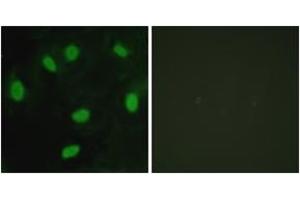 Immunofluorescence analysis of HeLa cells, using TBX15/18 Antibody. (T-Box 15/18 antibody  (AA 161-210))