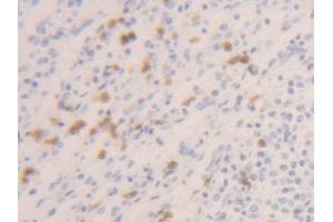 DAB staining on IHC-P; Samples: Human Spleen Tissue (Caspase 1 antibody  (AA 120-297))