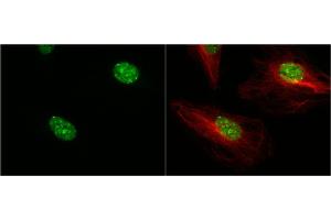ICC/IF Image 53BP1 antibody [N1], N-term detects 53BP1 protein at nucleus by immunofluorescent analysis. (TP53BP1 antibody  (N-Term))