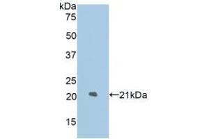 Detection of Recombinant LAMP2, Rat using Polyclonal Antibody to Lysosomal Associated Membrane Protein 2 (LAMP2)