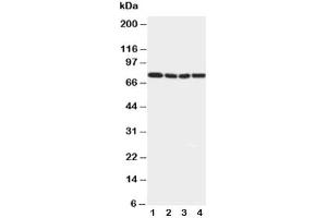 Western blot testing of IRAK1 antibody and Lane 1:  rat liver (IRAK1 antibody  (N-Term))