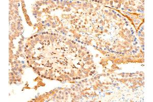 Immunohistochemistry (IHC) image for anti-serum/glucocorticoid Regulated Kinase 1 (SGK1) (pSer422) antibody (ABIN6256329)