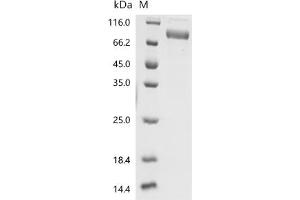 Interleukin 6 Receptor, alpha (IL6RA) (AA 20-357) protein (hFc Tag)