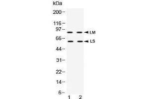 Western blot testing of human 1) HeLa and 2) K562 cell lysate with ADAM28 antibody at 0.