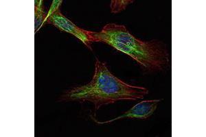 Immunofluorescence analysis of NIH/3T3 cells using RICTOR mouse mAb (green). (RICTOR antibody)