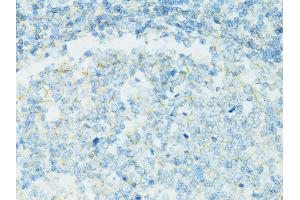 Immunohistochemistry of paraffin-embedded human vermiform appendix using CD19 antibody (ABIN5971402) at dilution of 1/100 (40x lens). (CD19 antibody)