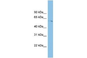 WB Suggested Anti-TINAGL1 Antibody Titration: 0. (TINAGL1 antibody  (Middle Region))
