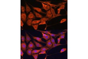 Immunofluorescence (IF) image for anti-Aldolase C, Fructose-Bisphosphate (ALDOC) (AA 1-170) antibody (ABIN6136788)