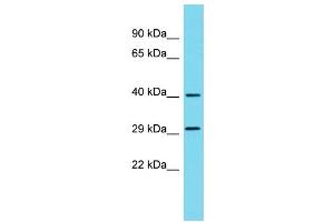 Host: Rabbit Target Name: METAP1D Sample Type: 293T Whole Cell lysates Antibody Dilution: 1.