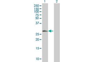 Western Blot analysis of SPINT2 expression in transfected 293T cell line by SPINT2 MaxPab polyclonal antibody. (SPINT2 antibody  (AA 1-252))