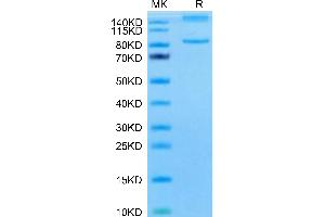 Mouse ITGAL&ITGB2 on Tris-Bis PAGE under reduced condition. (Integrin alpha L beta 2 (ITGAL & ITGB2) Heterodimer (AA 24-1087) protein (His tag))