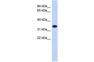 Image no. 1 for anti-Actin-Related Protein T1 (ACTRT1) (AA 287-336) antibody (ABIN6741144) (ACTRT1 antibody  (AA 287-336))