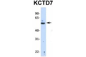 Host:  Rabbit  Target Name:  KCTD7  Sample Type:  Human Fetal Lung  Antibody Dilution:  1. (KCTD7 antibody  (N-Term))