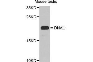 Western blot analysis of extracts of mouse testis, using DNAL1 antibody (ABIN5974658) at 1/1000 dilution.