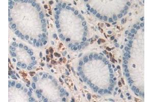 Immunohistochemistry (IHC) image for anti-Tumor Necrosis Factor alpha (TNF alpha) (AA 77-233) antibody (ABIN7429988)