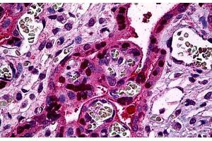 Human Placenta: Formalin-Fixed, Paraffin-Embedded (FFPE) (STAT5B antibody  (AA 678-788))