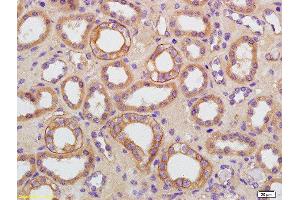 Formalin-fixed and paraffin embedded human kidney labeled with Rabbit Anti-AQP9 Polyclonal Antibody, Unconjugated  at 1:200 followed by conjugation to the secondary antibody and DAB staining (AQP9 antibody  (AA 201-295))