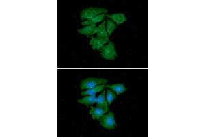 ICC/IF analysis of TUBG1 in HeLa cells. (TUBG1 antibody  (AA 1-451))