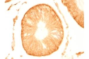 Formalin-fixed, paraffin-embedded Rat Testis stained with Pgp9. (UCHL1 antibody)