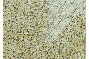 ABIN6277601 at 1/100 staining Human gastric tissue by IHC-P. (NUDT1 antibody  (Internal Region))
