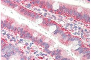 Human Small Intestine (formalin-fixed, paraffin-embedded) stained with CFL1 antibody ABIN364365 at 10 ug/ml followed by biotinylated anti-mouse IgG secondary antibody ABIN481714, alkaline phosphatase-streptavidin and chromogen. (Cofilin antibody  (AA 1-166))