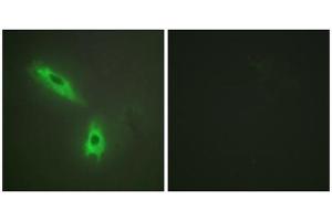 Immunofluorescence analysis of HeLa cells, using TNFC antibody. (LTB antibody  (C-Term))