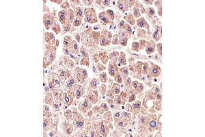 Immunohistochemical analysis of paraffin-embedded H. (ALDH6A1 antibody)