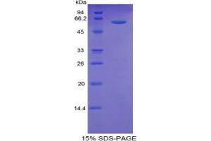 SDS-PAGE analysis of Human Thrombospondin 4 Protein.