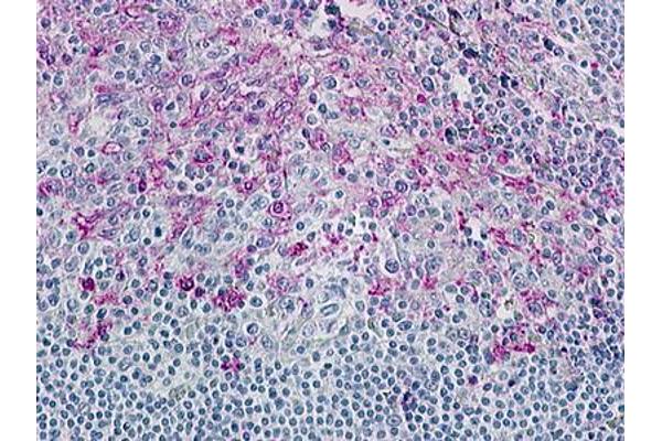 CCR8 antibody  (Cytoplasmic Domain)