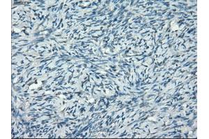 Immunohistochemical staining of paraffin-embedded colon tissue using anti-PPP5Cmouse monoclonal antibody.
