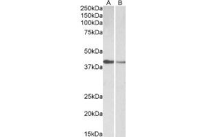 ABIN2613399 (0. (Cardiac Troponin T2 antibody  (AA 201-213))