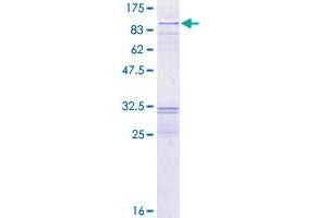 Image no. 1 for RecQ Protein-Like (DNA Helicase Q1-Like) (RECQL) (AA 1-649) protein (GST tag) (ABIN1317749) (RecQ Protein-Like (DNA Helicase Q1-Like) (RECQL) (AA 1-649) protein (GST tag))