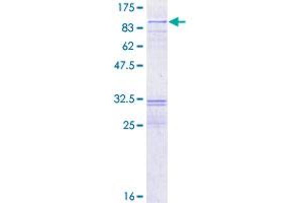 RecQ Protein-Like (DNA Helicase Q1-Like) (RECQL) (AA 1-649) protein (GST tag)