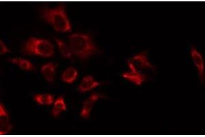 ABIN6277353 staining NIH-3T3 by IF/ICC. (CXCR2 antibody  (C-Term))