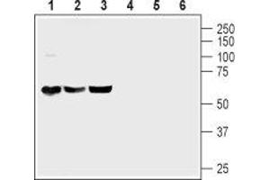 Western blot analysis of mouse brain (lanes 1 and 4), rat brain (lanes 2 and 5) and rat cerebellum (lanes 3 and 6) lysates: - 1-3. (ADCYAP1R1 antibody  (C-Term, Intracellular))