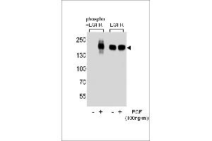 Western blot analysis of extracts from A431 cell, untreated or treated with EGF, using phospho-EGFR-p (left) or ErBB2 antibody (right). (EGFR antibody  (pSer1070))