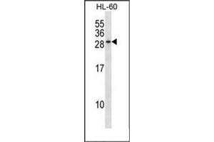 Western blot analysis of RAB15 Antibody (Center) in HL-60 cell line lysates (35ug/lane). (RAB15 antibody  (Middle Region))
