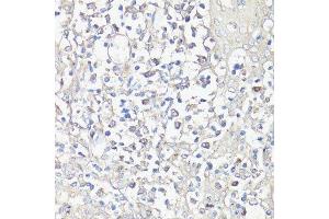 Immunohistochemistry (Paraffin-embedded Sections) (IHC (p)) image for anti-Nuclear Factor of Activated T-Cells, Cytoplasmic, Calcineurin-Dependent 1 (NFATC1) (AA 20-300) antibody (ABIN3022101)