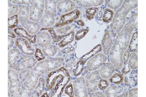 Immunohistochemistry of paraffin-embedded mouse kidney using ITGAV antibody. (CD51 antibody)