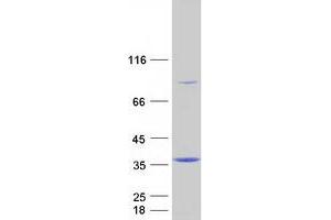Western Blotting (WB) image for Translocase of Outer Mitochondrial Membrane 34 (TOMM34) protein (Myc-DYKDDDDK Tag) (ABIN2712385)