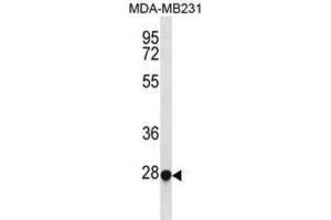 Western Blotting (WB) image for anti-Transcription Factor EC (TFEC) antibody (ABIN3000962) (TFEC antibody)