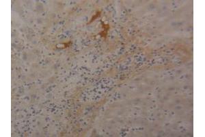 Immunohistochemistry (Paraffin-embedded Sections) (IHC (p)) image for anti-Fibrinogen beta Chain (FGB) (AA 29-491) antibody (ABIN2929200)