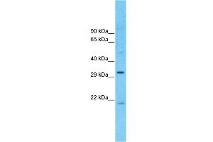 Host:  Rabbit  Target Name:  MCUR1  Sample Type:  OVCAR-3 Cell lysates  Antibody Dilution:  1. (CCDC90A antibody  (Middle Region))