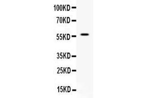 Western blot analysis of APEX2 expression in rat kidney extract ( Lane 1).