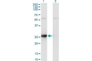 Western Blot analysis of TK1 expression in transfected 293T cell line by TK1 monoclonal antibody (M11), clone 2A2. (TK1 antibody  (AA 1-234))