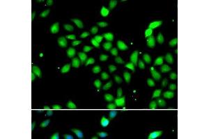 Immunofluorescence analysis of A549 cells using METTL13 Polyclonal Antibody